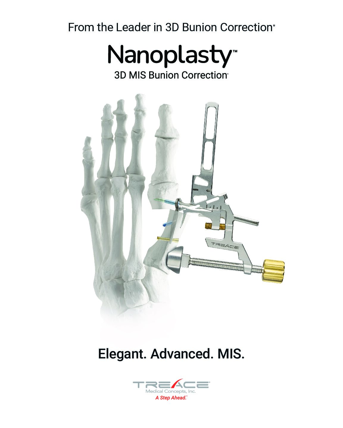 Nanoplasty™ Overview