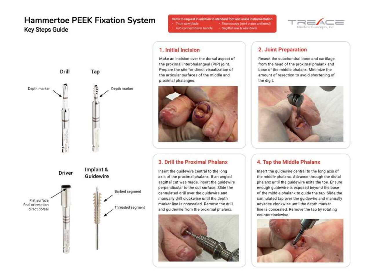 Key Steps