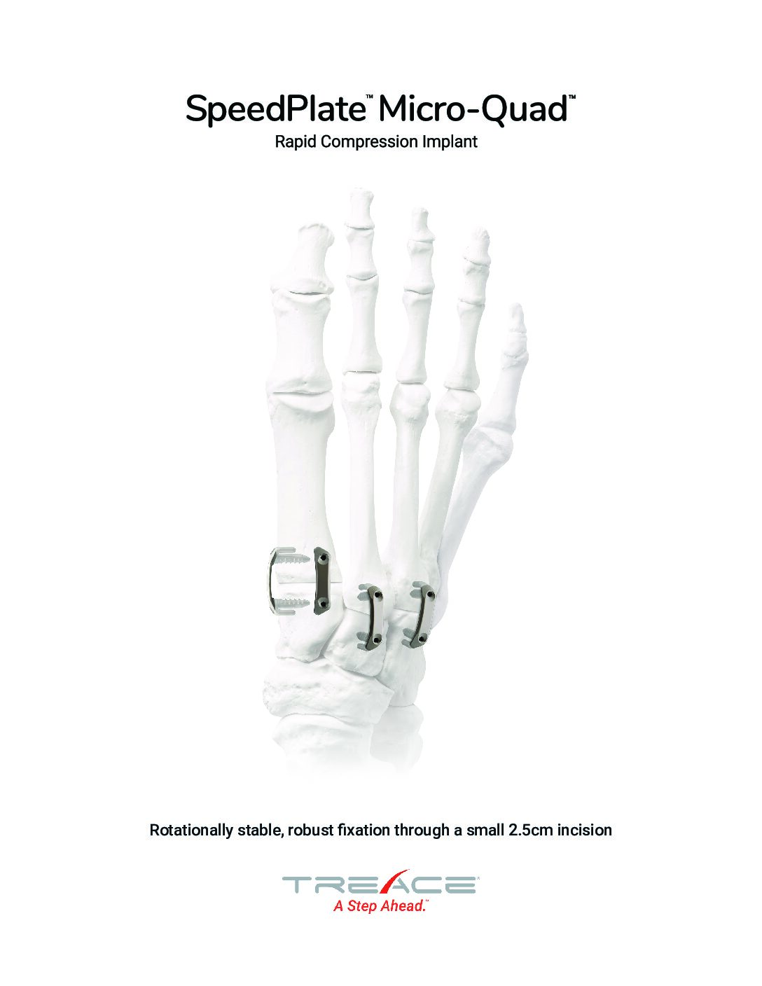 SpeedPlate™ Micro-Quad™ Overview Brochure